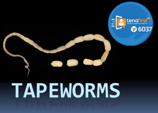 tapeworms-የኮሶትል