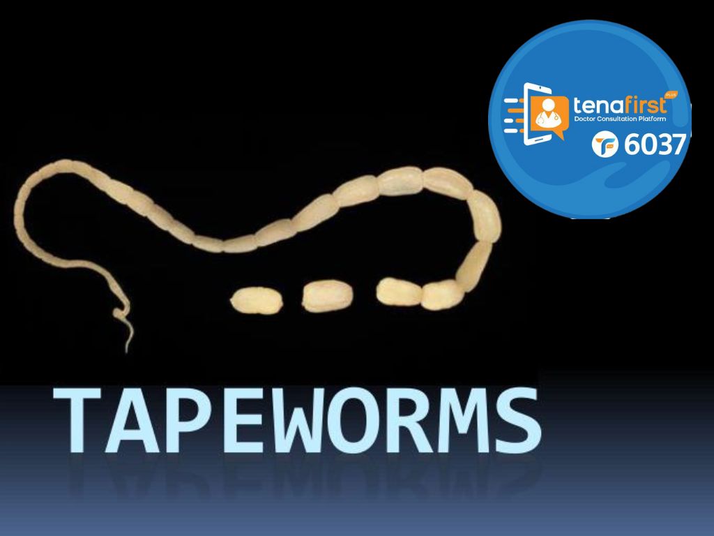 tapeworms-የኮሶትል